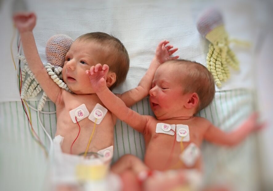 tweeling neonatologie materniteit